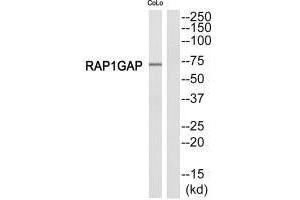 Western blot analysis of extracts from COLO205 cells, using RAP1GDS1 antibody. (RAP1GAP 抗体  (C-Term))