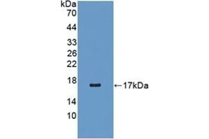 Detection of Recombinant RBP5, Human using Polyclonal Antibody to Retinol Binding Protein 5, Cellular (RBP5)