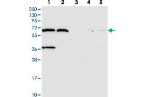 Western blot analysis of Lane 1: RT-4, Lane 2: U-251 MG, Lane 3: Human Plasma, Lane 4: Liver, Lane 5: Tonsil with ADAMTSL5 polyclonal antibody . (ADAMTS-Like 5 抗体)