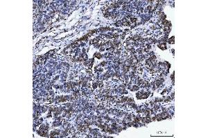 IHC analysis of Lamin A+C/LMNA using anti-Lamin A+C/LMNA antibody (ABIN7601843). (Lamin A/C 抗体  (AA 481-646))