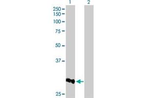 Western Blot analysis of CCNB1IP1 expression in transfected 293T cell line by CCNB1IP1 MaxPab polyclonal antibody. (CCNB1IP1 抗体  (AA 1-277))