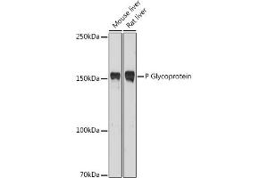 Western blot analysis of extracts of various cell lines, using P Glycoprotein antibody (ABIN6134228, ABIN6136339, ABIN6136342 and ABIN6215442) at 1:1000 dilution. (ABCB1 抗体  (AA 600-700))