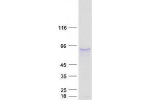 TRAF6 Protein (Transcript Variant 2) (Myc-DYKDDDDK Tag)