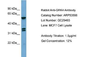 WB Suggested Anti-GRK4  Antibody Titration: 0. (GRK4 抗体  (Middle Region))