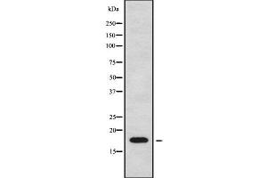 Western blot analysis of CKLF using Jurkat whole cell lysates (CKLF 抗体  (C-Term))
