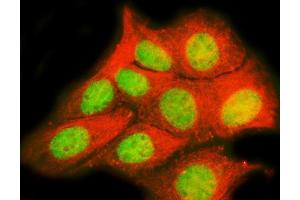 IF analysis of TRPS1 using anti-TRPS1 antibody (ABIN7601443) and anti-Tubulin Alpha antibody (ABIN7600339). (TRPS1 抗体  (AA 353-1257))