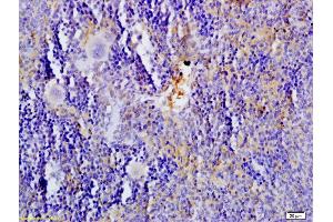 Formalin-fixed and paraffin embedded rat spleen tissue labeled with Anti-5-HTT/SLC6A4 Polyclonal Antibody, Unconjugated (ABIN735983) at 1:200 followed by conjugation to the secondary antibody and DAB staining (SLC6A4 抗体  (AA 401-500))
