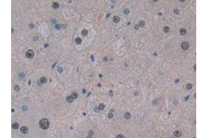 Detection of ChAT in Human Liver Tissue using Polyclonal Antibody to Choline Acetyltransferase (ChAT)