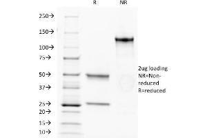 SDS-PAGE Analysis Purified CD34 MAb (HPCA1/1171). (CD34 抗体)