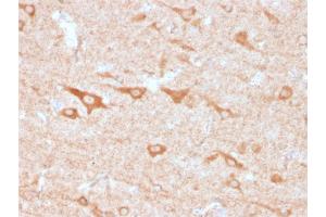 Immunohistochemistry (IHC) image for anti-Tumor Necrosis Factor Receptor Superfamily, Member 9 (TNFRSF9) (AA 19-188) antibody (ABIN6939788)