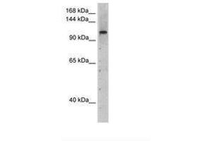 Image no. 1 for anti-PRP6 Pre-mRNA Processing Factor 6 Homolog (PRPF6) (AA 51-100) antibody (ABIN204965) (PRP6/ANT-1 抗体  (AA 51-100))