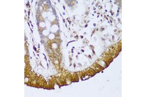 Immunohistochemistry (IHC) image for anti-GRIP and Coiled-Coil Domain Containing 2 (GCC2) (AA 1-300) antibody (ABIN6141007)
