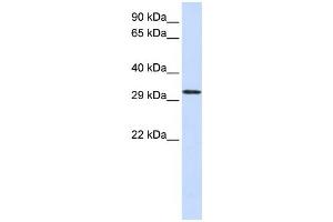 Western Blotting (WB) image for anti-Chromosome 21 Open Reading Frame 2 (C21orf2) antibody (ABIN2458962) (C21orf2 抗体)
