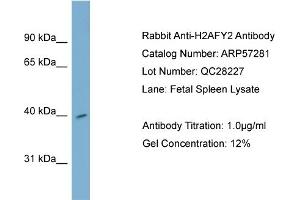 WB Suggested Anti-H2AFY2  Antibody Titration: 0. (H2AFY2 抗体  (Middle Region))