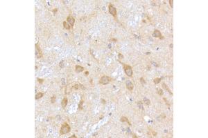 Immunohistochemistry of paraffin-embedded rat brain using TR Rabbit mAb (ABIN7270870) at dilution of 1:200 (40x lens). (TRAPPC2 抗体)