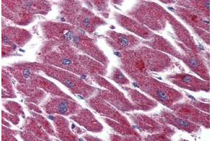 Human Heart (formalin-fixed, paraffin-embedded) stained with LPAR3 antibody ABIN399993 at 5 ug/ml followed by biotinylated goat anti-rabbit IgG secondary antibody ABIN481713, alkaline phosphatase-streptavidin and chromogen. (LPAR3 抗体  (Internal Region))