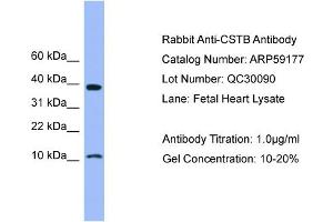 WB Suggested Anti-CSTB  Antibody Titration: 0. (CSTB 抗体  (N-Term))
