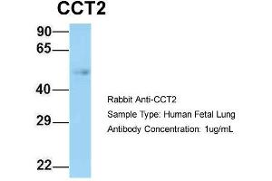Host: Rabbit  Target Name: CCT2  Sample Tissue: Human Fetal Lung  Antibody Dilution: 1. (CCT2 抗体  (N-Term))