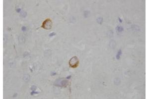 Immunohistochemistry (IHC) image for anti-Nitric Oxide Synthase 1, Neuronal (NOS1) (AA 1-181), (N-Term) antibody (ABIN1108474)