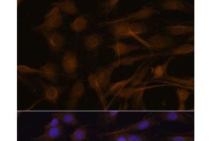 Immunofluorescence analysis of C6 cells using TIMP2 Polyclonal Antibody at dilution of 1:100. (TIMP2 抗体)
