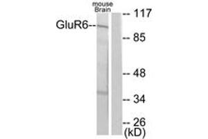Western blot analysis of extracts from mouse brain cells, using mGluR6 Antibody. (Metabotropic Glutamate Receptor 6 抗体  (AA 828-877))