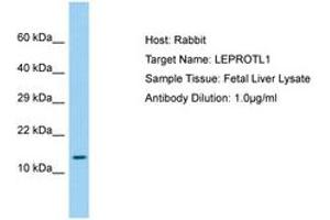 Image no. 1 for anti-Leptin Receptor Overlapping Transcript-Like 1 (LEPROTL1) (AA 37-86) antibody (ABIN6750210) (LEPROTL1 抗体  (AA 37-86))