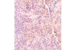 Immunohistochemical staining of rat spleen tissue with 5 ug/mL SQSTM1 polyclonal antibody . (SQSTM1 抗体  (C-Term))
