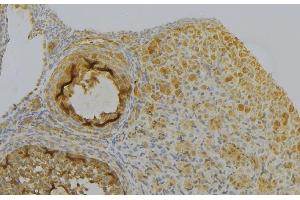 ABIN6277028 at 1/100 staining Human gastric tissue by IHC-P. (Peroxiredoxin 6 抗体  (Internal Region))
