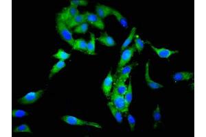 Immunofluorescent analysis of Hela cells using ABIN7168715 at dilution of 1:100 and Alexa Fluor 488-congugated AffiniPure Goat Anti-Rabbit IgG(H+L) (SCG3 抗体  (AA 205-432))