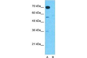 Host:  Rabbit  Target Name:  TMEM16A  Sample Type:  Human Fetal Muscle  Lane A:  Primary Antibody  Lane B:  Primary Antibody + Blocking Peptide  Primary Antibody Concentration:  1ug/ml  Peptide Concentration:  5ug/ml  Lysate Quantity:  25ug/lane/lane  Gel Concentration:  0. (ANO1 抗体  (Middle Region))