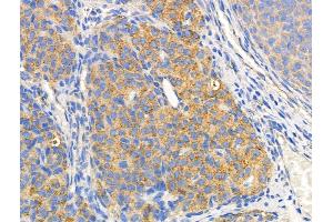 ABIN6258520 and ABIN6274742 at 1/100 staining Rat ovarian tissue by IHC-P.