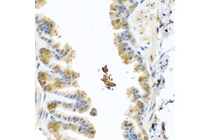 Immunohistochemistry of paraffin-embedded mouse lung using CHI3L2 antibody (ABIN5975154) at dilution of 1/100 (40x lens). (CHI3L2 抗体)