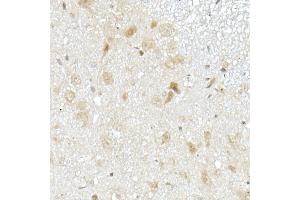 Immunohistochemistry (IHC) image for anti-Methylthioadenosine phosphorylase (MTAP) (AA 1-283) antibody (ABIN6144119)
