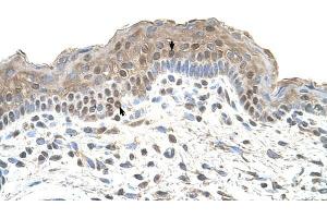 TAPBP antibody was used for immunohistochemistry at a concentration of 4-8 ug/ml to stain Squamous epithelial cells (arrows) in Human Skin. (TAPBP 抗体)
