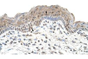 TAPBP antibody was used for immunohistochemistry at a concentration of 4-8 ug/ml to stain Squamous epithelial cells (arrows) in Human Skin.