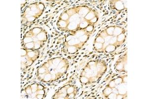 Immunohistochemistry (Paraffin-embedded Sections) (IHC (p)) image for anti-Poly A Binding Protein Nuclear 1 (PABPN1) antibody (ABIN7075116)