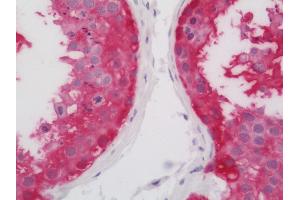 Human Testis: Formalin-Fixed, Paraffin-Embedded (FFPE). (ASB9 抗体  (FITC))