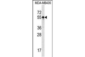 Western blot analysis in MDA-MB435 cell line lysates (35ug/lane). (SLC15A3 抗体  (AA 168-197))