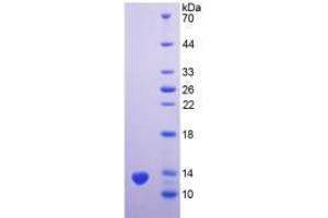 SDS-PAGE analysis of Human PSCA Protein. (PSCA 蛋白)