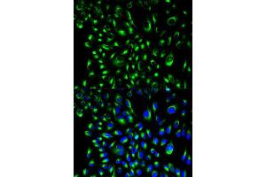 Immunofluorescence (IF) image for anti-Lymphocyte Cytosolic Protein 2 (SH2 Domain Containing Leukocyte Protein of 76kDa) (LCP2) (AA 284-533) antibody (ABIN3023382)