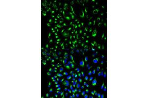 Immunofluorescence analysis of HeLa cell using LCP2 antibody. (LCP2 抗体  (AA 284-533))