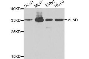 Western blot analysis of extracts of various cell lines, using ALAD antibody (ABIN5974581) at 1/1000 dilution. (ALAD 抗体)