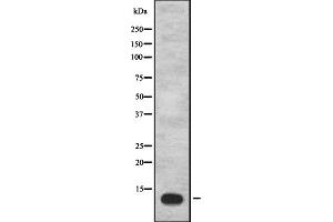 Western blot analysis of IGFL1 expression in Hela cell lysate,The lane on the left is treated with the antigen-specific peptide. (IGFL1 抗体)