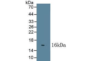 Detection of Recombinant NGF, Bovine using Polyclonal Antibody to Nerve Growth Factor (NGF) (Nerve Growth Factor 抗体  (AA 122-241))