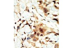 Image no. 2 for anti-Insulin Receptor (INSR) (N-Term) antibody (ABIN359886) (Insulin Receptor 抗体  (N-Term))