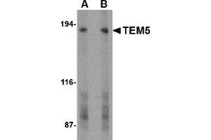 Western Blotting (WB) image for anti-G Protein-Coupled Receptor 124 (GPR124) (C-Term) antibody (ABIN1030729) (GPR124 抗体  (C-Term))