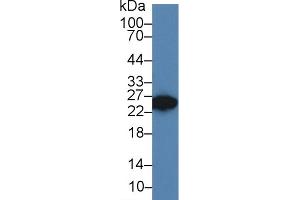 Western Blot; Sample: Rat Seminal vesicle lysate; Primary Ab: 3µg/ml Rabbit Anti-Rat DKKL1 Antibody Second Ab: 0. (Dickkopf-Like 1 (DKKL1) (AA 21-230) 抗体)