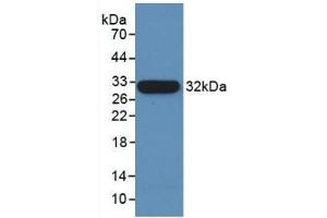 Detection of Recombinant TUBb, Human using Monoclonal Antibody to Tubulin Beta (TUBb) (TUBB 抗体  (AA 170-419))