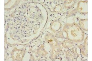Immunohistochemistry of paraffin-embedded human kidney tissue using ABIN7171269 at dilution of 1:100 (STXBP6 抗体  (AA 2-210))