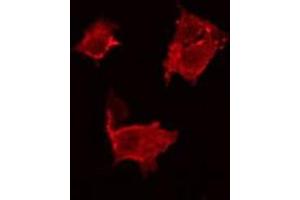 ABIN6266858 staining HeLa by IF/ICC. (BCAR3 抗体  (C-Term))